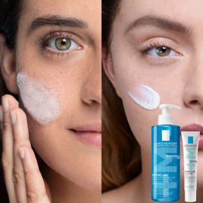 Pimple care discount